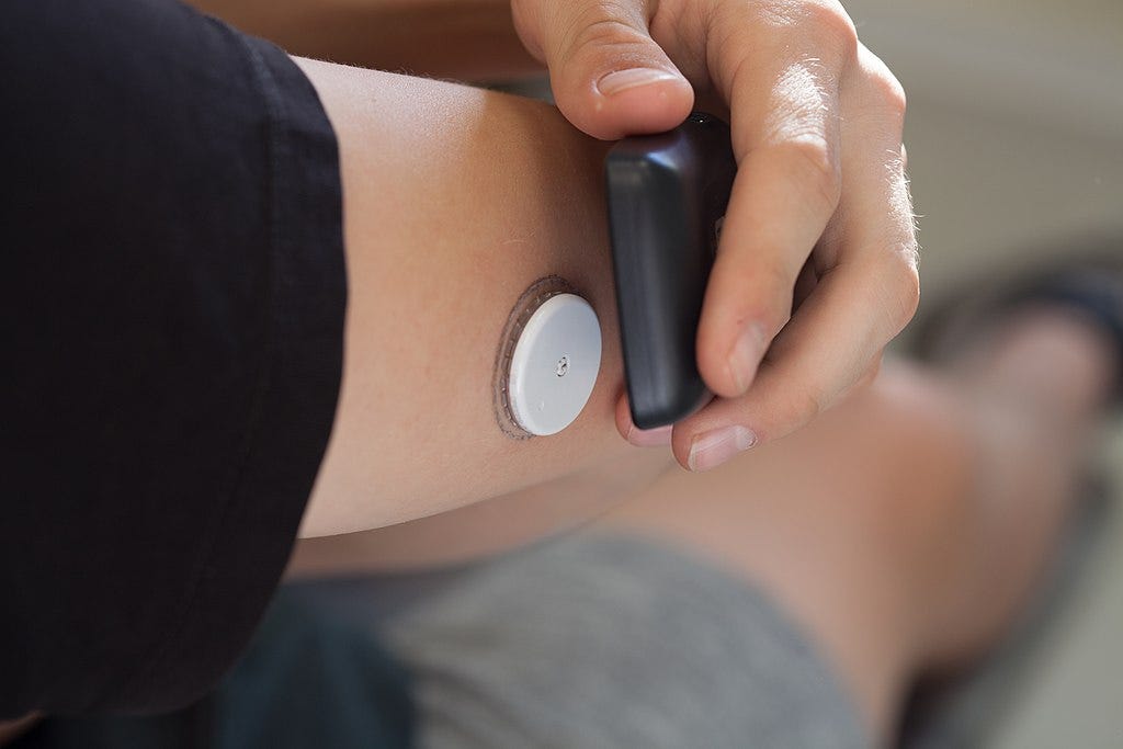 Holding a phone to scan a glucose monitor attached to an arm